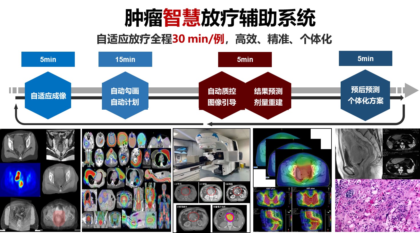 腫瘤智慧放療輔助系統(tǒng)